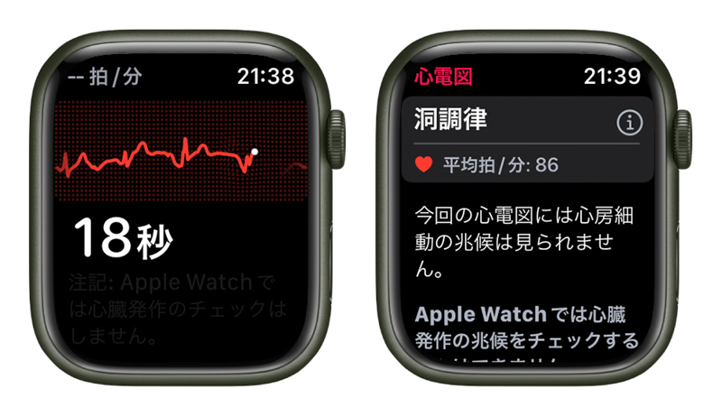 心電図 Apple Watchアプリ