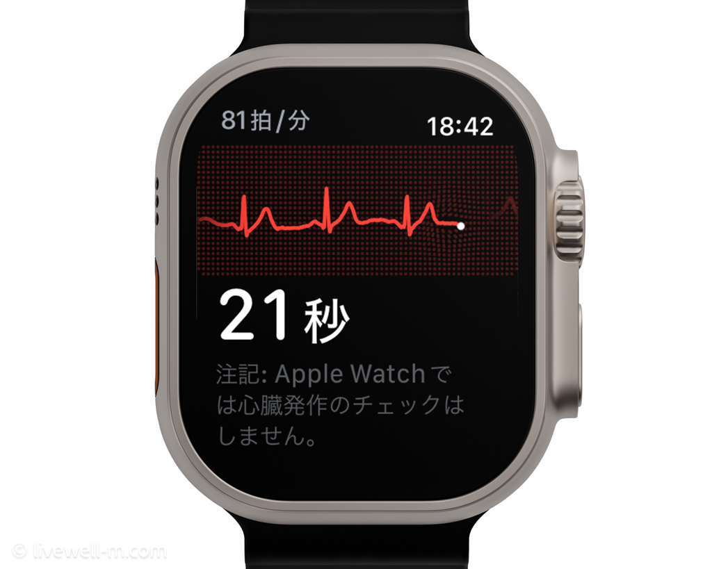 心電図（ECG）を測定できる（Apple Watchでできること）
